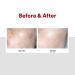 Medi-Peel Melanon X Cream 1.01 fl oz - Dark Spot Reducer & Anti-Aging Treatment - Buy Online on GoSupps.com