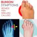 Bunion Splint Flat Sandal - Comfortable Blue Beach Sandal for Women with Stylish Foot Correction Design | Bunion Corrector Flip Flops - Buy Online on GoSupps.com