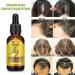 Ginger Hair Growth Serum - Anti Hair Loss Treatment for Men & Women - Buy Online on GoSupps.com