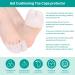 DYKOOK Covered Toe Sleeves - 2 Pairs of Cushioning Gel Toe Caps with Metatarsal Pads for Comfortable Toes, Pain Relief, and Callus Prevention - for Women & Men - Buy Online on GoSupps.com