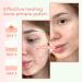 AINA Hydrocolloid Pimple Patches - Invisible Acne Spot Dots | Clear Natural Zit Patches | 48 Dots + Bonus Chin & Nose Patches - Buy Online on GoSupps.com