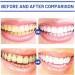 3 Days Teeth Whitening Powder Teeth Whitening Powder for White Teeth | Teeth Whitening | Visible Cleaning Effect | Safe Teeth Whitener - Cosmetic Teeth Cleaning (3) - Buy Online on GoSupps.com