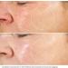 Retinol Face Cream with Hyaluronic Acid, Vitamin E - Anti Aging & Wrinkle Reduction | Day & Night Use - Moisturizer for Women - Buy Online on GoSupps.com