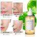 Generic Centella Asiatica Face Serum - Revitalize Your Skin with Soothing and Hydrating Formula Calming Soothing Hydrating Serum for Women Korean Skincare Serum - Buy Online on GoSupps.com