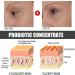 Caffeine Solution 5% + Egcg Caffeine Eye Cream For Wrinkles Caffeine & Hyaluronic Acid Under Eye Serum Caffeine Eye Serum Anti Aging Under Eye Cream For Reduce Circles And Puffy Eyes Eye Bag Removal - Buy Online on GoSupps.com