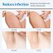 Ingrown Hair Treatment Serum Roll-on | Razor Bump & After Shave Solution - Fast Relief Worldwide - Buy Online on GoSupps.com