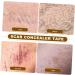 Scar Concealing Tape Invisible Skin Tone Patch Scar Cover Sticker for Body Arms Legs Neck Backpack Travel - Buy Online on GoSupps.com