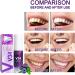 V34 Purple Toothpaste for Whiter Teeth | Frilla Oral Foam & Stain Removal | Improve Tooth Health | International Shipping - Buy Online on GoSupps.com