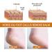Horse Oil Callus Balm Foot Care Cream Removes Keratin and Moisturizes Foot Skin Horse Oil Foot Care Cream - Buy Online on GoSupps.com