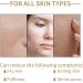 Rice Toner 150ML Smoothing Pore Minimizer & Moisturising Facial Toner - Niacinamide Essence for Dry Skin - Redness & Exfoliating - 1pc - Buy Online on GoSupps.com