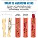 Varicose Veins Treatment Cream Raura Varicose Veins Treatment Cream Raura Varicose Veins Cream Cream for Varicose Veins Ointment for Varicose Veins Varicose Veins Cream (5pcs) - Buy Online on GoSupps.com