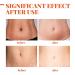 Stretch Marks Repair Essential Oil | Improve Skin Elasticity for Pregnancy Care Shop Now! - Buy Online on GoSupps.com