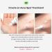 TIAM Centella Blending Powder 0.35 Oz - CICA Powder for Sebum Control and Acne Marks with Asiaticoside and Madecassic Acid - Buy Online on GoSupps.com