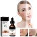 Serum for the correction of dark spots for face and body antipigmentation spots face melanin correcting facial care for men and women even skin tone - Buy Online on GoSupps.com