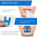 H-Shape Sleep Mouth Tape 60 Pcs - Stop Snoring and Develop Nasal Breathing Habits (Blue) - Buy Online on GoSupps.com