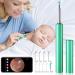 Ear Wax Removal Clean Kit