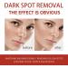 Kojic Acid Cream Dark Spot Remover for Face Skin Lightening Cream for Anti Aging Dark Spot Correcting Glow Serum Face Moisturizer for Women Pigmentation Removal Cream Freckle Removal Cream Dark Spots - Buy Online on GoSupps.com
