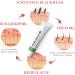 Anti Acne Cream for Acne Treatment and Spot Treatment with Nicotinamide Sodium Hyaluronate Aloe for Acne Prone & Sensitive Skin Reduce Redness Moisturiser Fade Acne Marks Oil Control - Buy Online on GoSupps.com