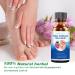 Extra Strength Toenail Fungus Treatment - Nail Repair Solution for Discolored Nails - Renew Damaged Toenails - Fingernail & Toenail Fungus Treatment - Buy Online on GoSupps.com