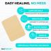 MedVance TM Silicone Adhesive Foam Dressing 15cm x 20cm - Box of 5 Dressings - Buy Online on GoSupps.com