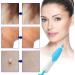 Skin Tag Remover Device 40x Removal Bands for Fast & Effective Wart Removal - 2-8mm - Buy Online on GoSupps.com