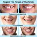 Smile Teeth Veneers - 50 Premium Temporary Crowns for Bad Tooth Coverage | Fast Styling & Healthy Materials | Includes Storage Box - Perfect for Cosmetic Dentistry - Buy Online on GoSupps.com