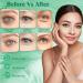 Nourishing Avocado Eye Patches- 60 PCS for Dark Circles, Puffiness, and Wrinkles: Hydrating and Firming Under Eye Masks - Buy Online on GoSupps.com
