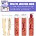 Shantou Youjia Varicose Veins Cream Leg Care Balm cream against broomsticks remove varicose veins and broomsticks natural leg care improves blood circulation nourishes and soothes tired - Buy Online on GoSupps.com