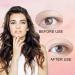 240 Pieces Invisible Eyelid Tapes L Instant Eyelid Lift Strips One-sided Sticky Eyelid Sticker with Tweezers Fork Bar Waterproof and Sweatproof for Heavy Hooded Droopy Uneven Mono-Eyelids - Buy Online on GoSupps.com