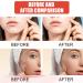 Zit Patches for Acne - 108Pcs Tea Tree Oil Clear Invisible Hydrocolloid Spot Dots - Day & Night Use - Buy Online on GoSupps.com