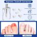 Professional Ingrown Toenail Treatment Kit - Includes Toenail Corrector, Tweezer, Strips, Braces, and Patches - Buy Online on GoSupps.com