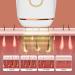 Pothit IPL Hair Removal Laser - Portable & Painless Intense Pulse Light for Face Legs Armpits & Bikini Zones | International Shipping Available - Buy Online on GoSupps.com
