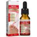 Ingrown Toenail Treatment - 30ml Ingrown Toenail - Cuticle Care Oils for Ingrown Toenails - Trimming Toenail Softening Drops Natural Ingrown Toenail Correction Treatment Fungal Nail Treatment