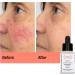Skincyclopedia Hydrating Serum with 3% Ceramide Oat Hyaluronic Acid and Niacinamide - Barrier Serum Cream with Retinol and Squalane - Anti Aging Moisturiser for Dry and/or Mature Skin 30ml - Buy Online on GoSupps.com