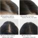 Hair Dye Stick for Hiding White Hair - Natural Hair Concealer Water Resistant - Long Lasting Contour Cream for Men - Camouflage Light Areas and Coloring - Buy Online on GoSupps.com