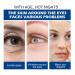 Jasmine Ointment - Dark Circle Removal & Eye Care Cream for All Skin Types (3PCs) | Active Jasmine Formula for Tear Bags & Eye Corn Loop - Buy Online on GoSupps.com