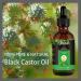 2Pack Castor Oil for Hair Growth - 100% Pure Cold Pressed Black Castor Oil with Scalp Massager for Hair Eyelashes Eyebrows & Skin Care - Buy Online on GoSupps.com