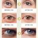 Vitamin C Eye Creams Anti-wrinkle Eye Cream Firming Eye Cream Under Eye Cream for Dark Circles and Puffy Eyes Eye Cream for Eye Bag Remover Anti-Wrinkle Anti-Aging Eye Creams - Buy Online on GoSupps.com