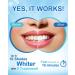 MySmile Teeth Whitening Pen Gel - Painless Whitener with Hydrogen Peroxide - Mint Flavor - 4ML - Non-Sensitive Formula - 1Pcs - Buy Online on GoSupps.com