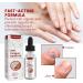 Quick Relief Oil Fungal Nail Treatment Rapid Relief Oil Nail Fungus Treatment For Toenail Nail Treatment Oil Toe Nail Fungal Treatment Onychomycosis Nail Treatment Toenail Repair for Damaged Nails - Buy Online on GoSupps.com