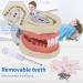 Dental Teeth Model Removable Tooth Teach Practice Model Teeth Model Includes 32Pcs Teeth for Practicing Restorative Techniques Come with A Small Screwdriver - Buy Online on GoSupps.com