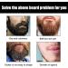 Firulab Bartshampoo | Natural Beard Cleaner & Moisturizer 30 ml - Softens & Strengthens Your Beard - Buy Online on GoSupps.com