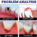 Instant Toothache Relief Spray for Effective Dental Pain Prevention | Fresh Breath Oral Spray for Portable Teeth Treatment - Buy Online on GoSupps.com