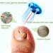 Home Nail Fungus Laser Treatment Device - 905nm Infrared & 470nm Blue Light for Onychomycosis - Buy Online on GoSupps.com