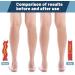 Buy Plus Size Compression Socks (S-7XL) 20-30 mmHg - Wide Calf Open Toe Support for Circulation Varicose Veins & Edema - USA Shipping Available - Buy Online on GoSupps.com