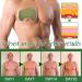 Pack of 5 compression patches for gynecomastia - Buy Online on GoSupps.com