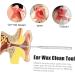 SKISUNO Professional Earwax Removal Tools Comfortable to Hold for Safe Ear Cleaning - Buy Online on GoSupps.com