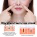 Blackhead Remover Mask - Peel Off Charcoal Face Mask for Deep Cleansing | Acne & Pore Control for Men & Women - Buy Online on GoSupps.com