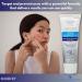 10% benzoyl peroxide- Acne Treatment 1 oz (Pack of 1) Boxed By Fusion Shop Store - Buy Online on GoSupps.com