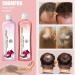 Onion & Rosemary Shampoo for Hair Growth | Biotin Anti Hair Loss Shampoo 16.76 fl oz - Buy Online on GoSupps.com